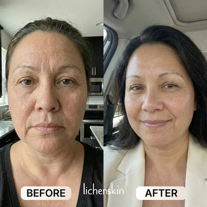 lichenskin' sCollagen Glow Up Mask