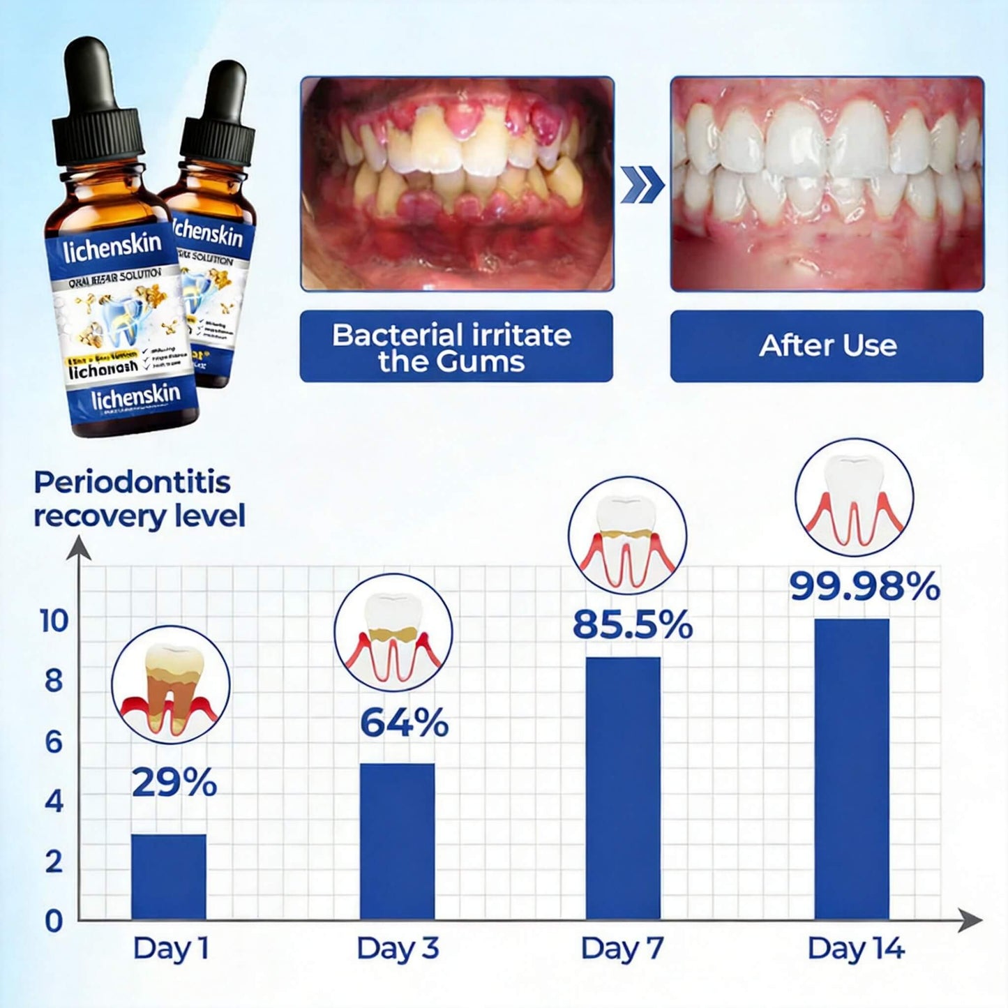 Lichenskin® BeeTakt – Clinically Proven Gum Repair Solution | 2026 Limited-Time Offer