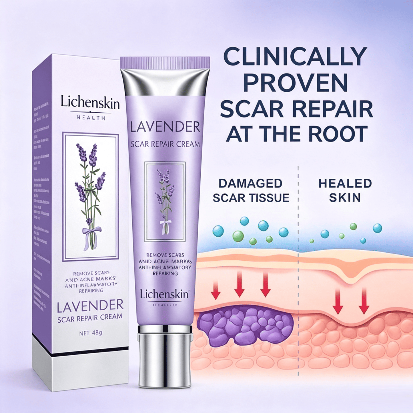 Real Healing Doesn't Require Expensive Appointments Lichenskin® Scar Repair Cream