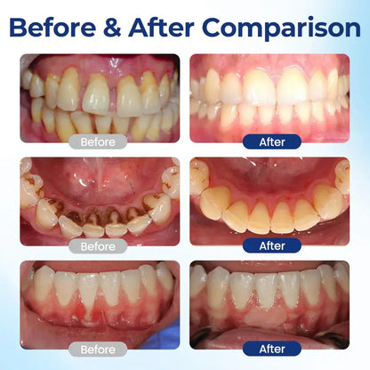 Lichenskin® BeeTakt – Clinically Proven Gum Repair Solution | 2026 Limited-Time Offer