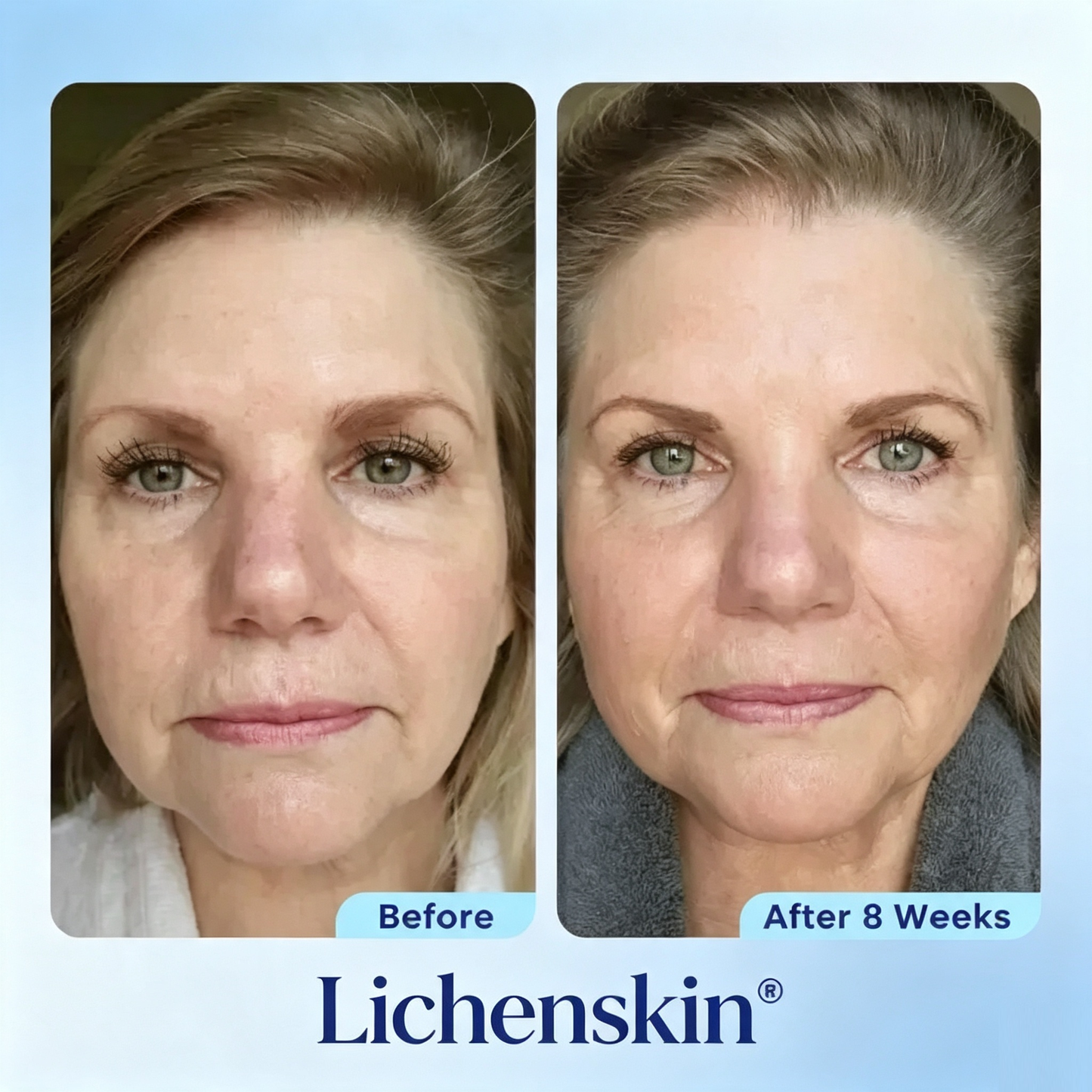 Lichenskin® Deep‑Sea Protein Anti‑Aging Eye Gel⚡ Fast‑Resultl ⚡