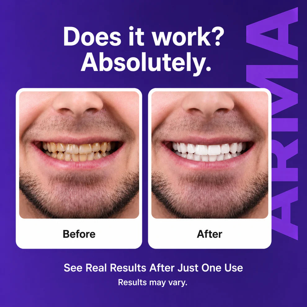 Purple Teeth Whitening Strips
