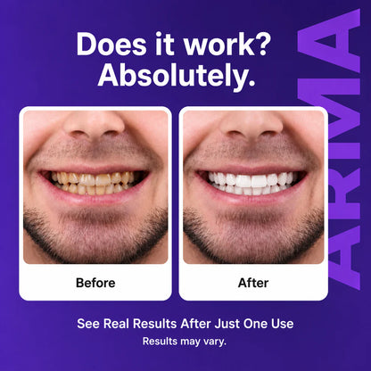 Purple Teeth Whitening Strips