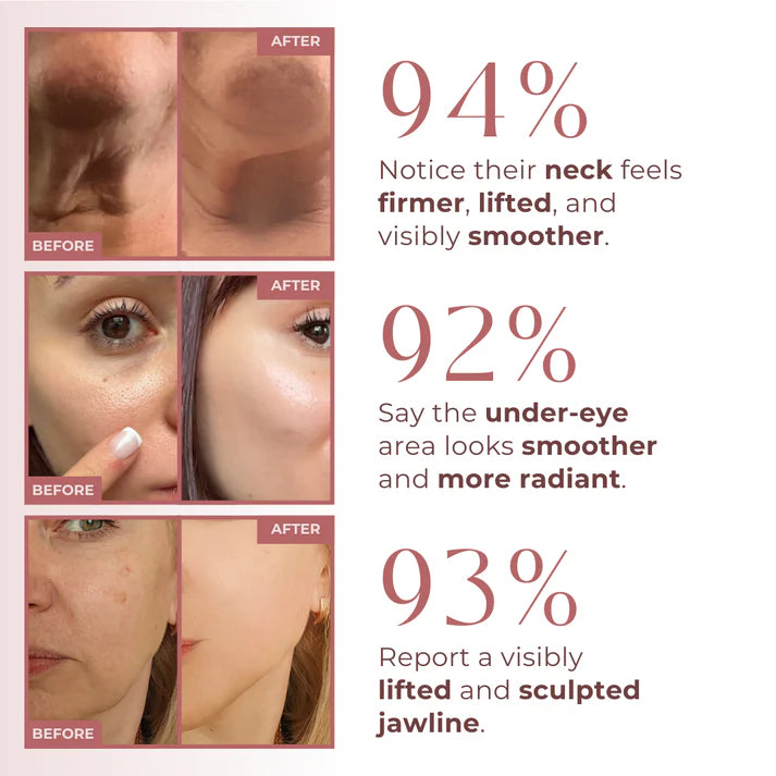 Lichenskin's Revive - Light Eye Massage Cream