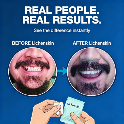 Lichenskin® Tooth Tinted Plastic - Natural Color - Temporary Tooth - Made in USA