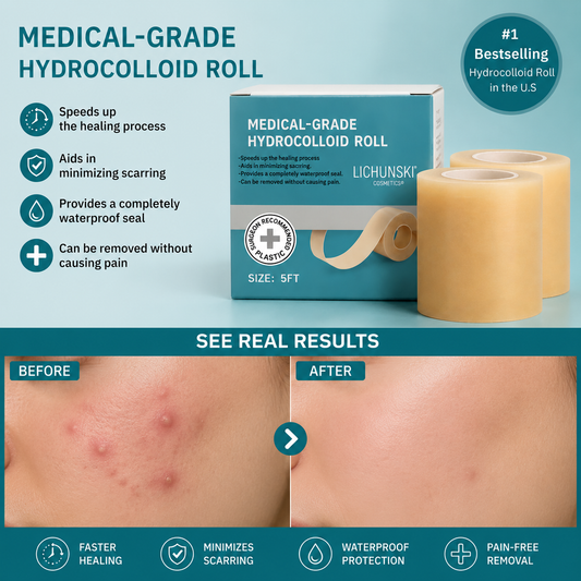 Lichenskin™ Hydrocolloid Acne Patches – The Easy Fix For Breakouts