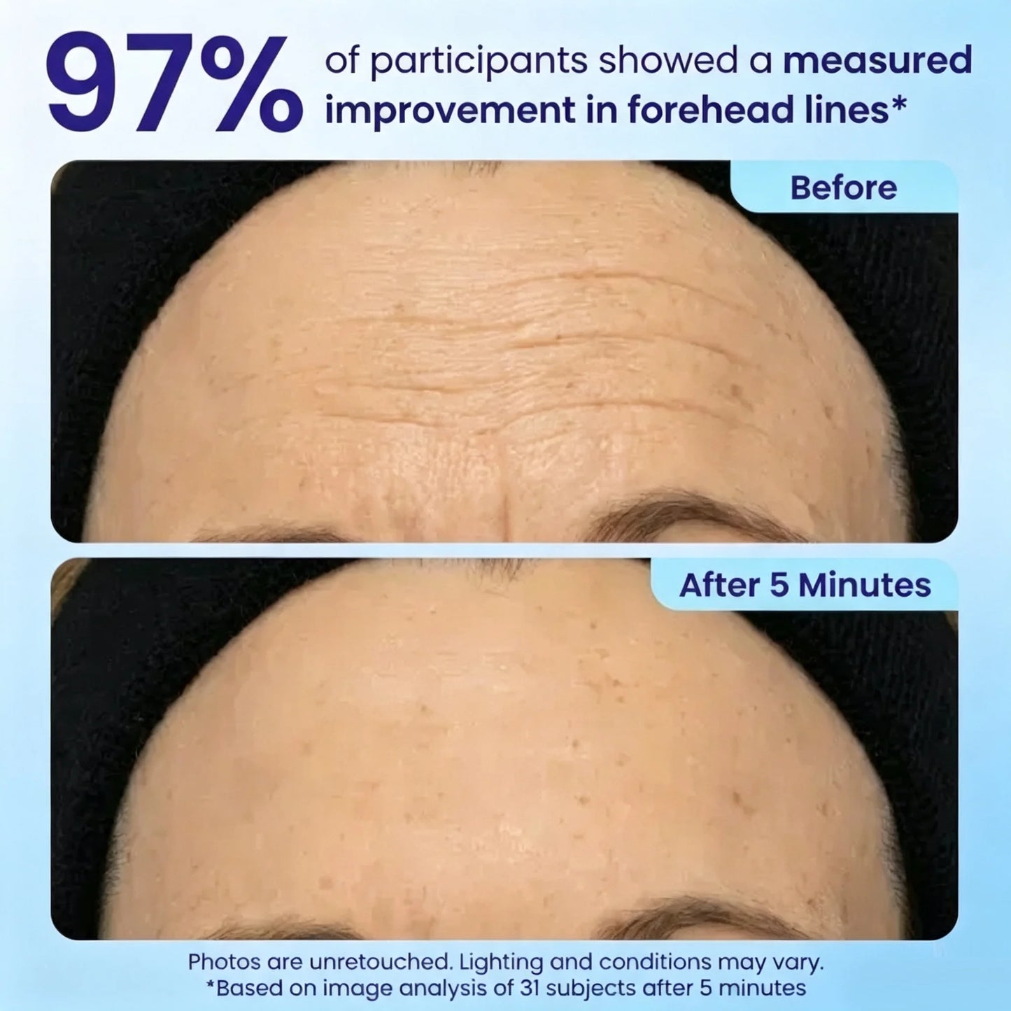 Lichenskin® Deep‑Sea Protein Anti‑Aging Eye Gel⚡ Fast‑Resultl ⚡