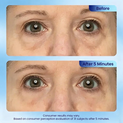 Lichenskin® Deep‑Sea Protein Anti‑Aging Eye Gel⚡ Fast‑Resultl ⚡
