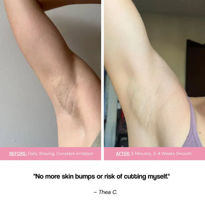 No Shave Hair Removal Cream - Sale