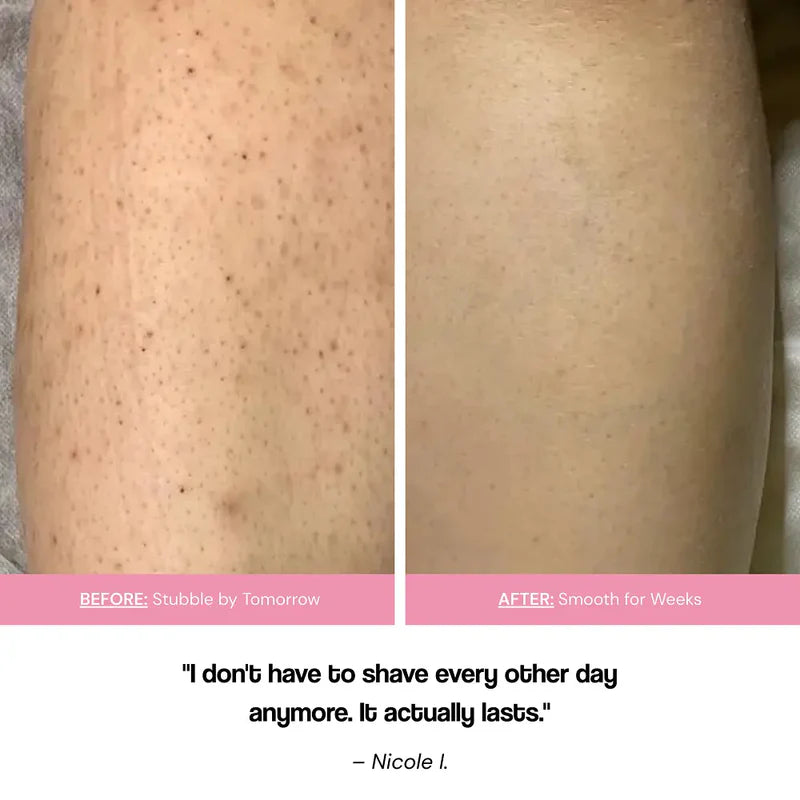 No Shave Hair Removal Cream - Sale