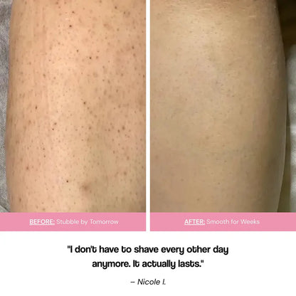 No Shave Hair Removal Cream - Sale