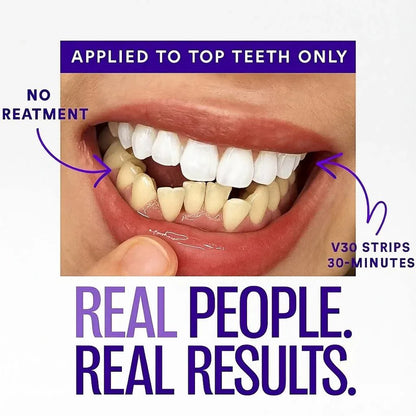 Purple Teeth Whitening Strips