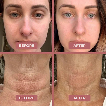 Lichenskin's Revive - Light Eye Massage Cream