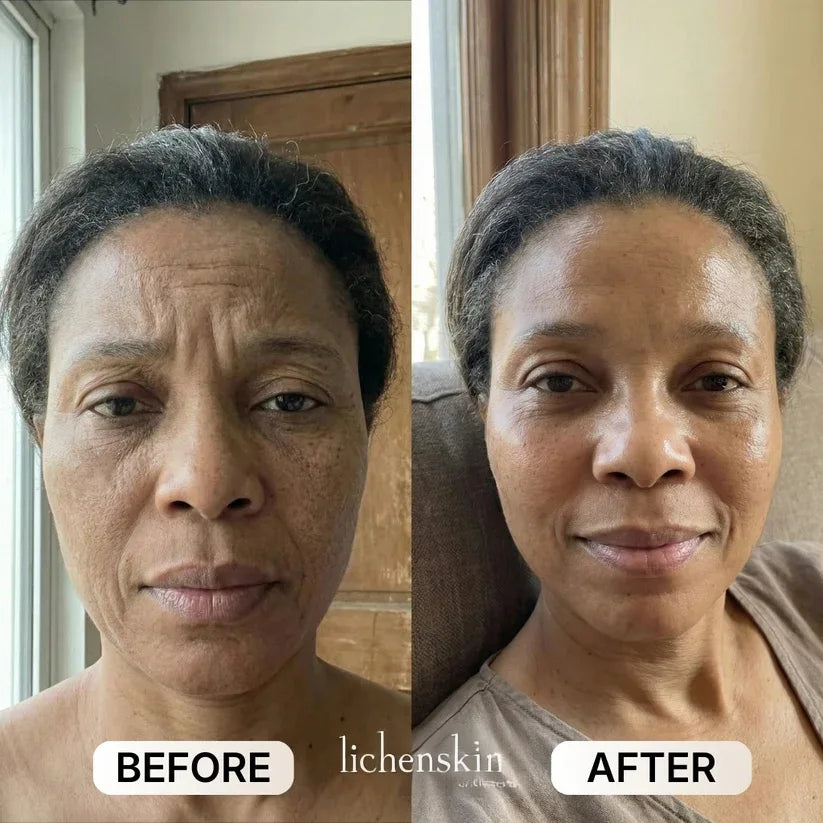 lichenskin' sCollagen Glow Up Mask