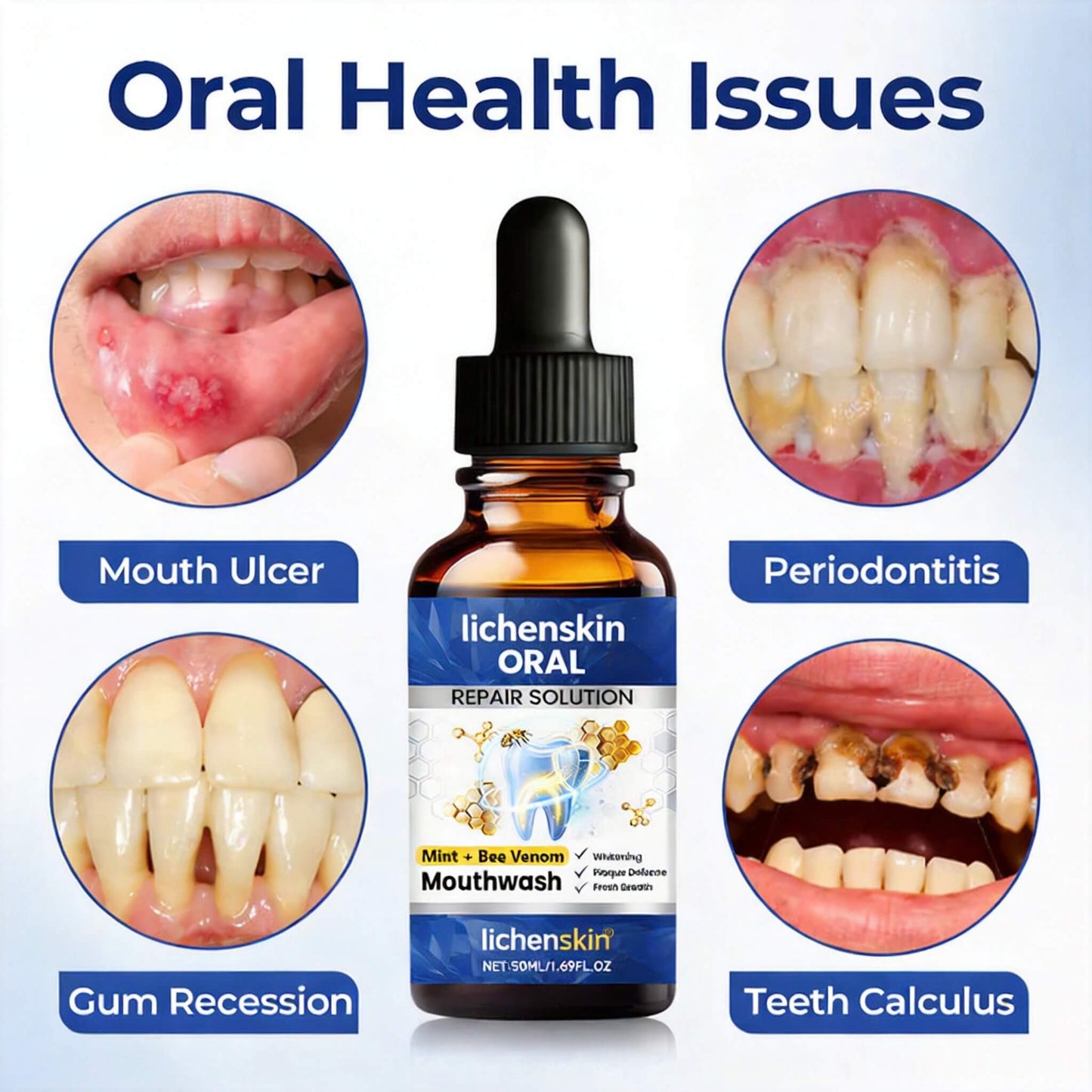 Lichenskin® BeeTakt – Clinically Proven Gum Repair Solution | 2026 Limited-Time Offer