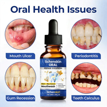 Lichenskin® BeeTakt – Clinically Proven Gum Repair Solution | 2026 Limited-Time Offer