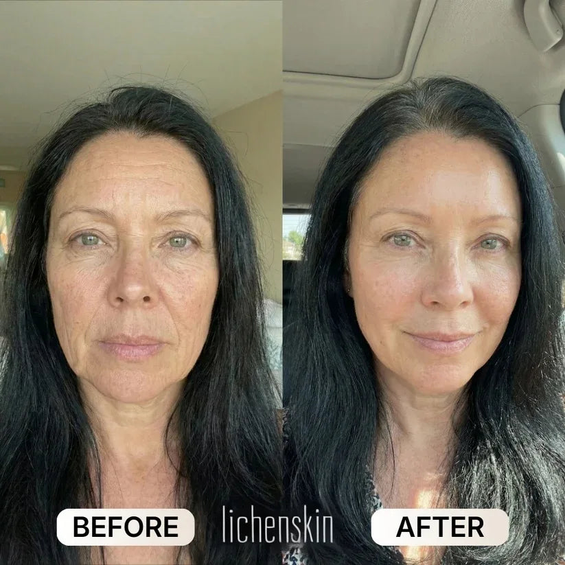 lichenskin' sCollagen Glow Up Mask
