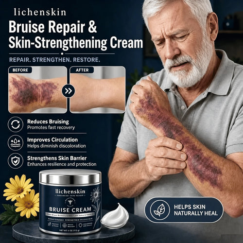 💥100K+ SOLD💕- Lichenskin® Bruise Repair & Skin-Strengthening Cream