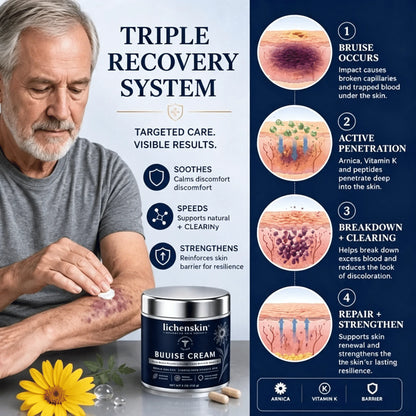 💥100K+ SOLD💕- Lichenskin® Bruise Repair & Skin-Strengthening Cream