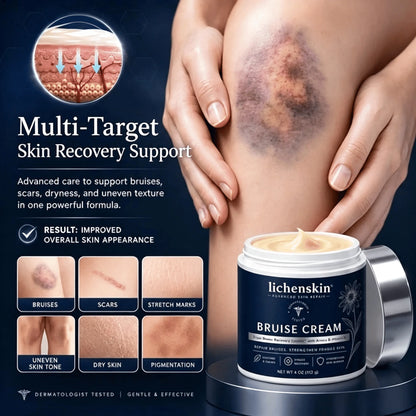 💥100K+ SOLD💕- Lichenskin® Bruise Repair & Skin-Strengthening Cream