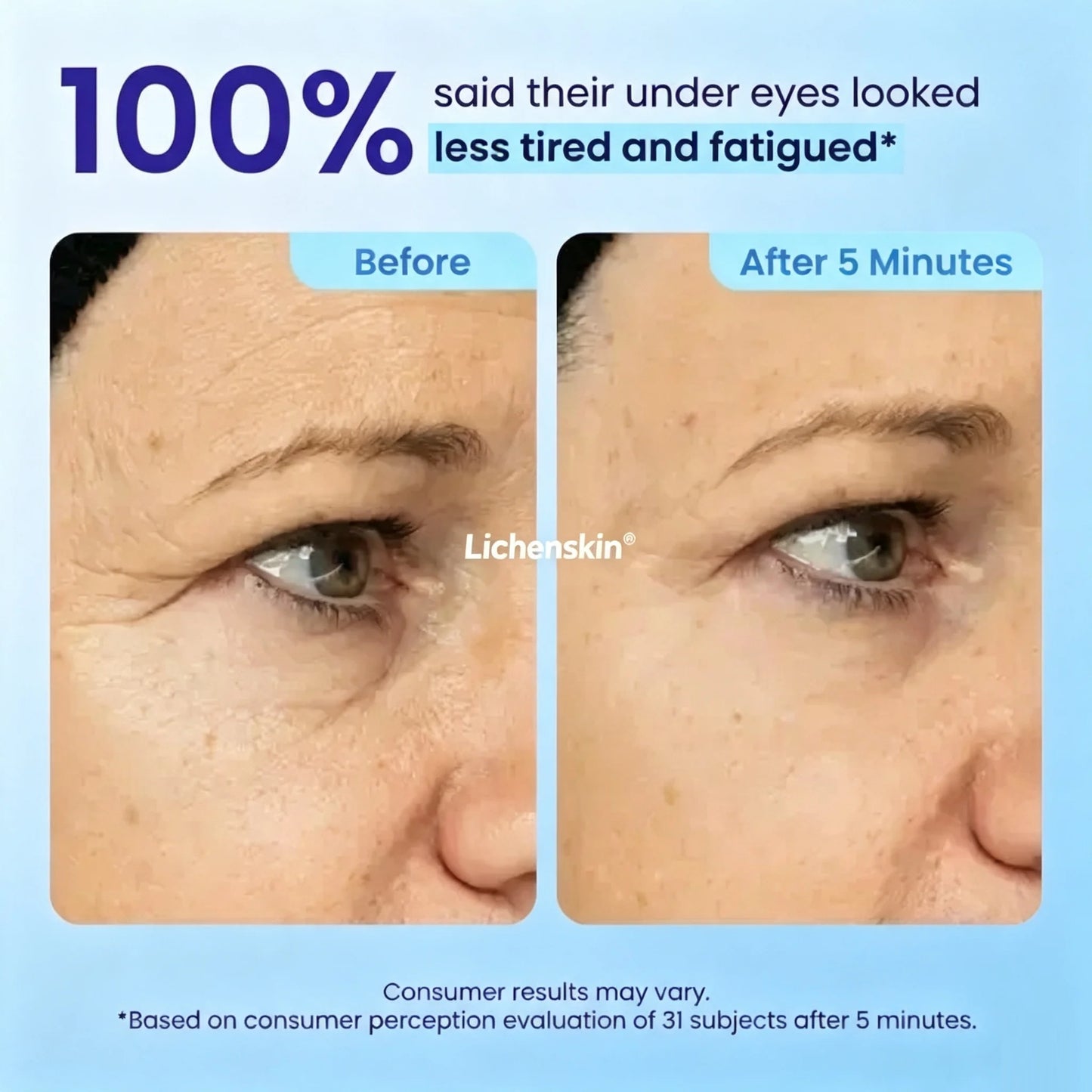 Lichenskin® Deep‑Sea Protein Anti‑Aging Eye Gel⚡ Fast‑Resultl ⚡